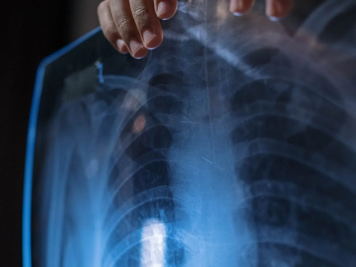 Asthma and allergy care